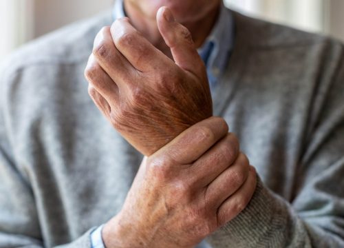 Man with arthritis in his wrist