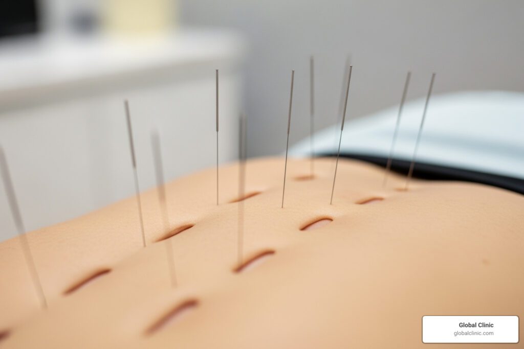 dry needling near me