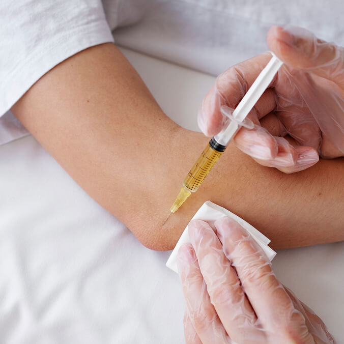 high-angle-patient-getting-elbow-prp-treatment 1 (1)