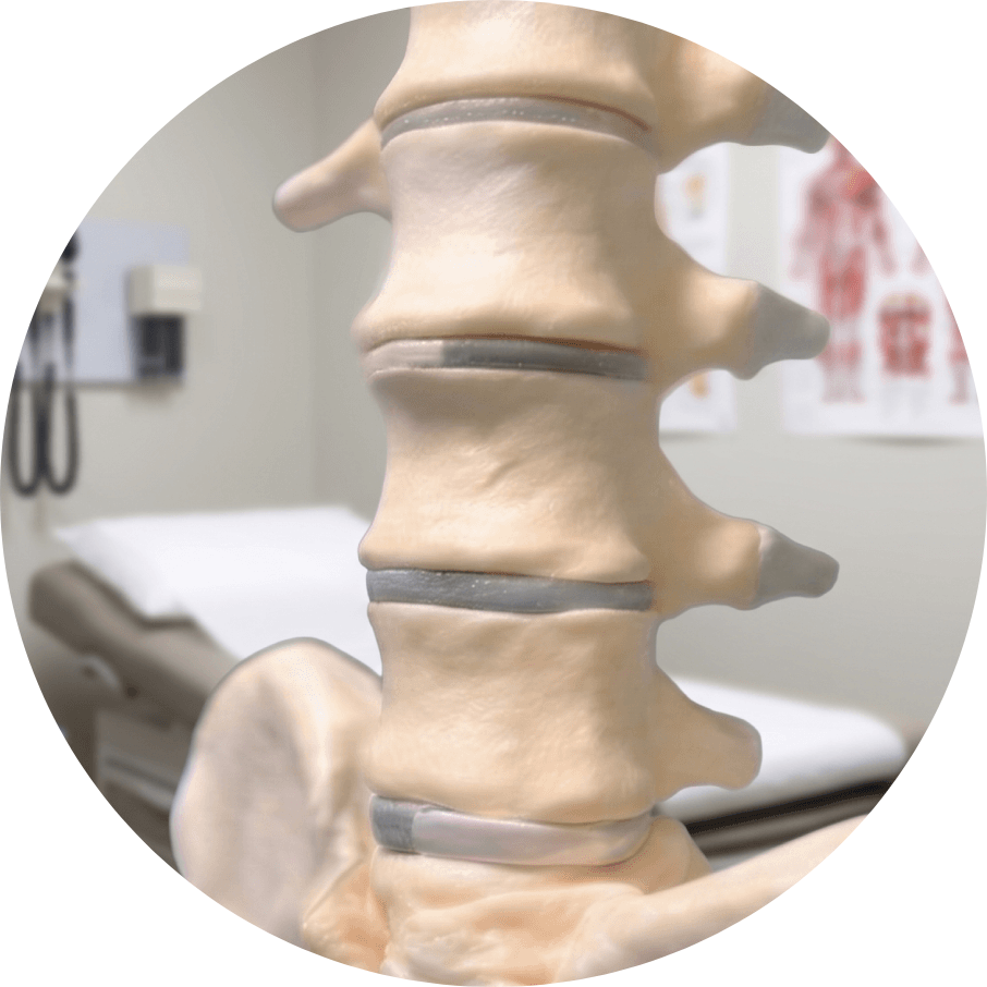 spine epidural injection