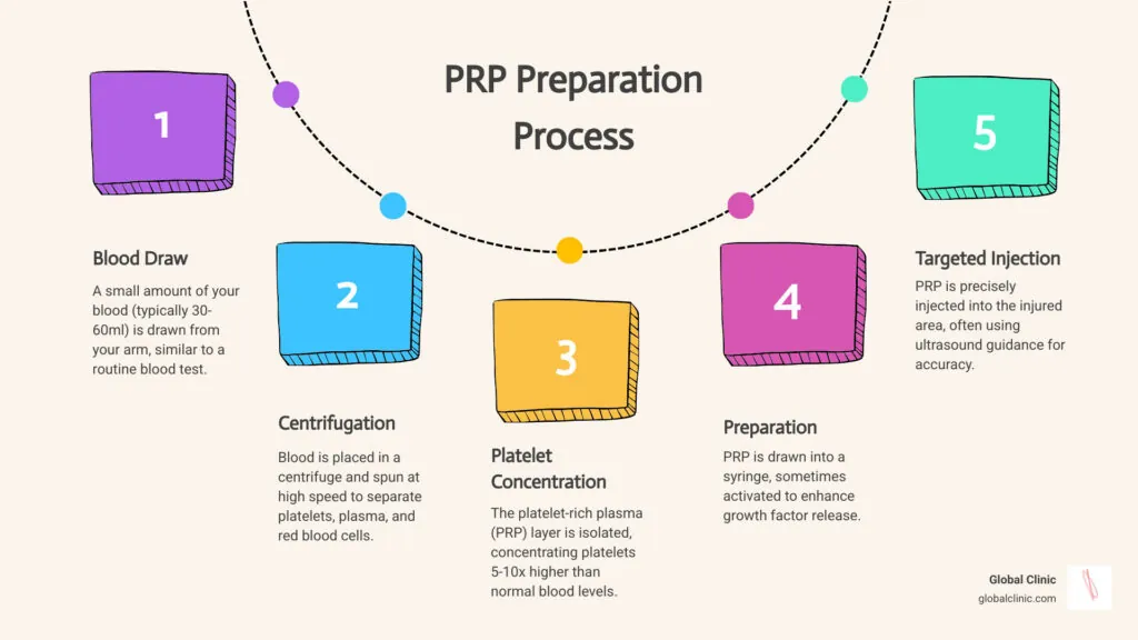 Infographic of the PRP preparation process: blood draw, centrifugation, platelet concentration and injection