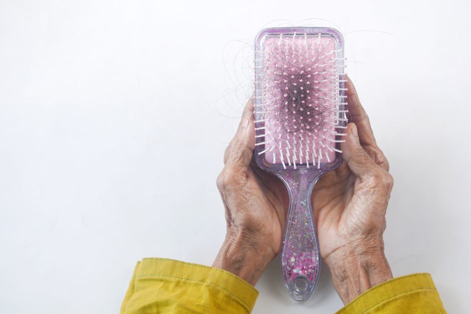prf injections for hair loss