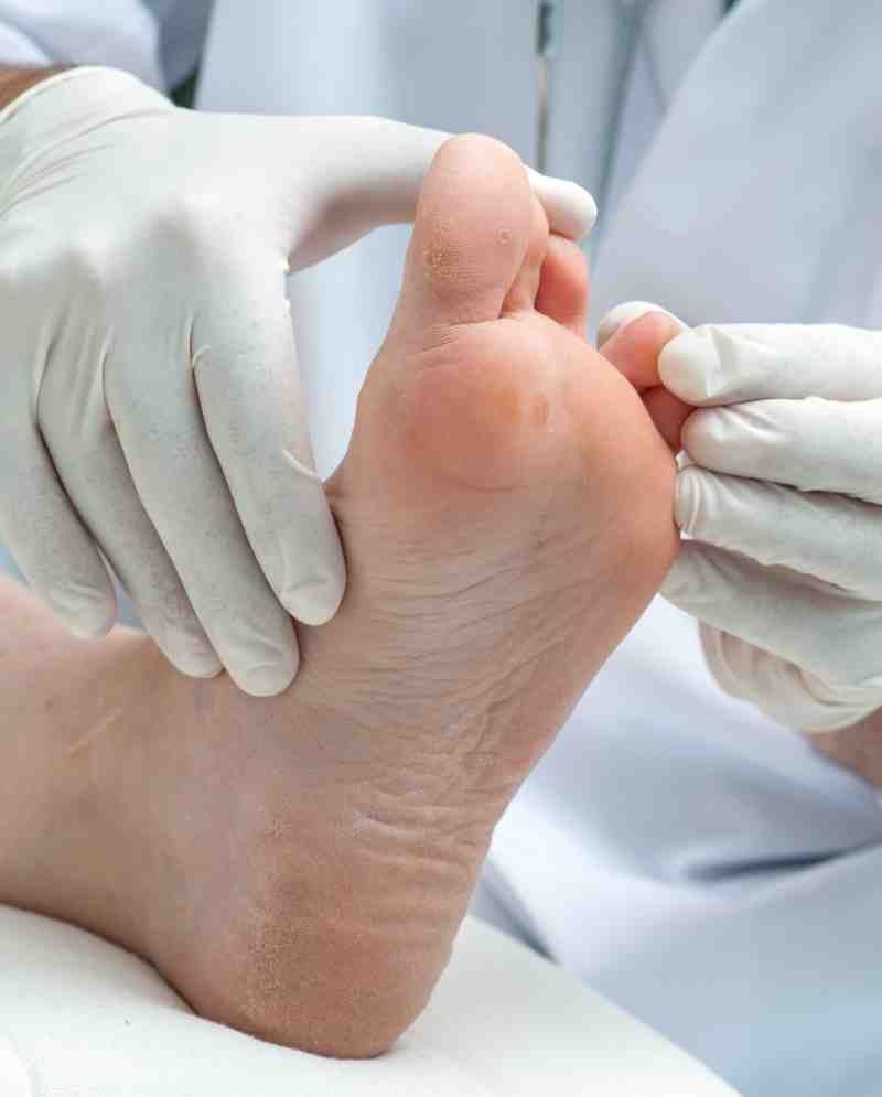 clinician examining foot arch